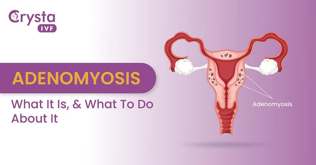 Adenomyosis Disease